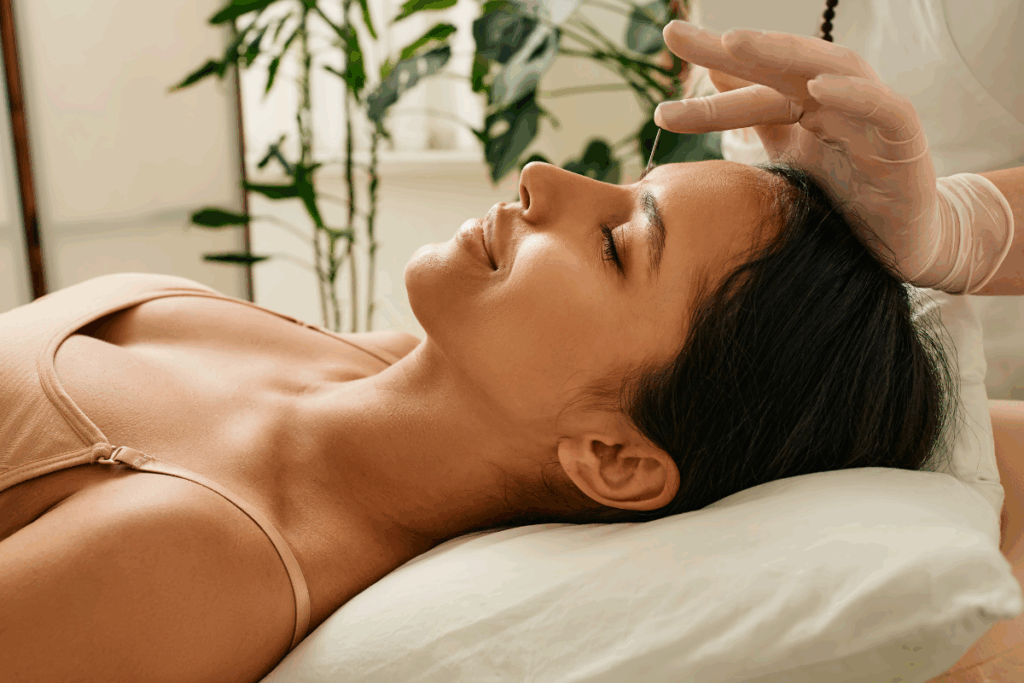 Acupuncture for migraine